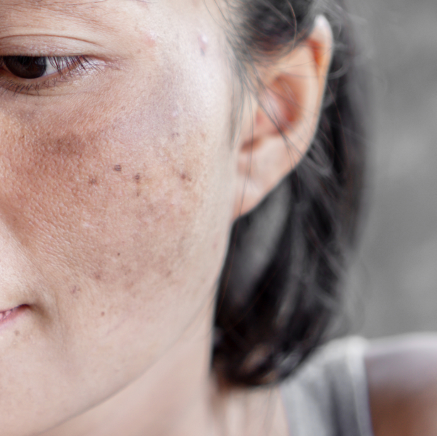 skin